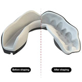 Mouth/Teeth Guard