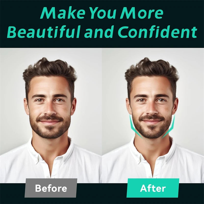 IronJaw Elite - Alpha Face Definer